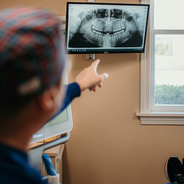 Doctor pointing at Digital x-ray